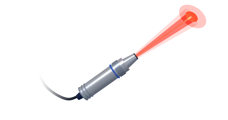 Лазерный аппарат для ЭВЛО